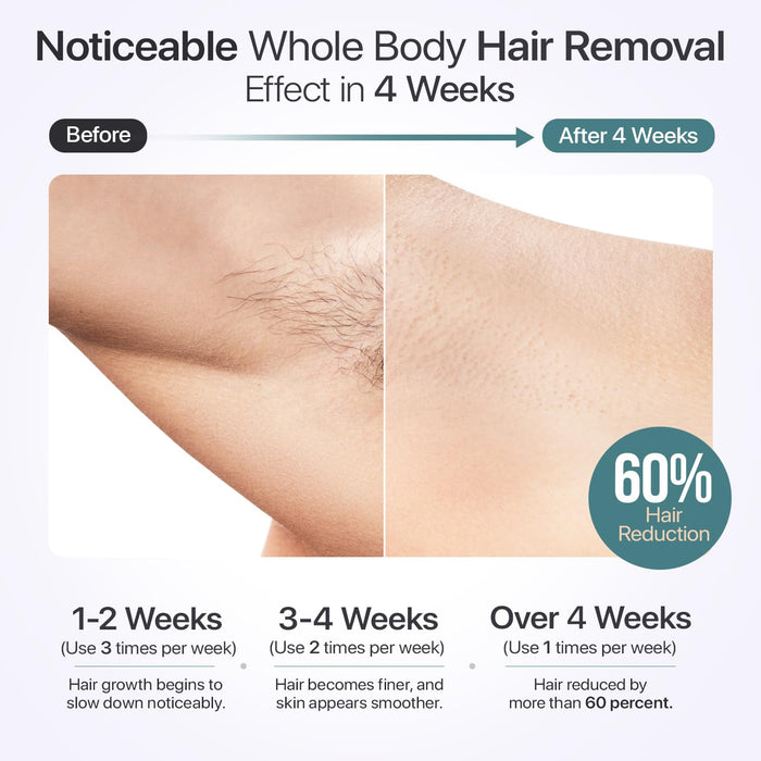 IPL Hair Removal Device with Cooling Technology – For Face & Body
