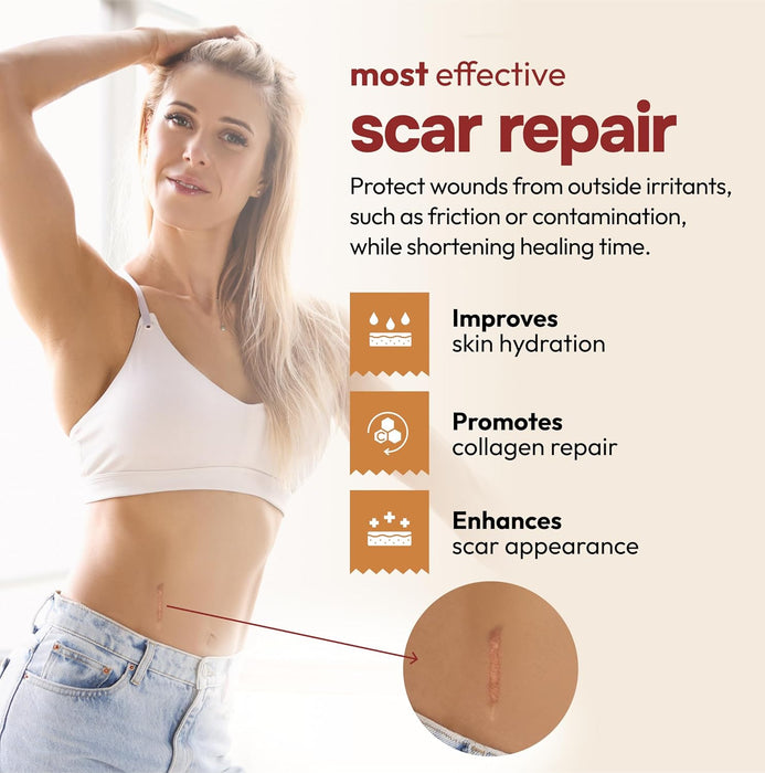 10 Pack Silicone Scar Sheets for Surgery & Stretch Marks