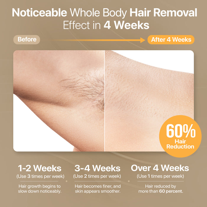 Sapphire Ice IPL Hair Removal Device – Painless At-Home Laser